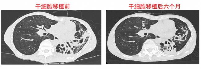 微信图片_20180208173419 微信图片_20180208173419